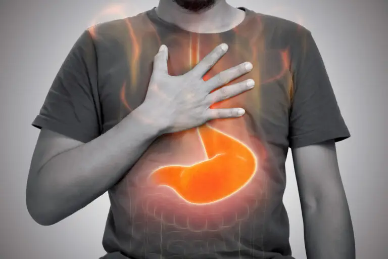 Acid reflux or Heartburn